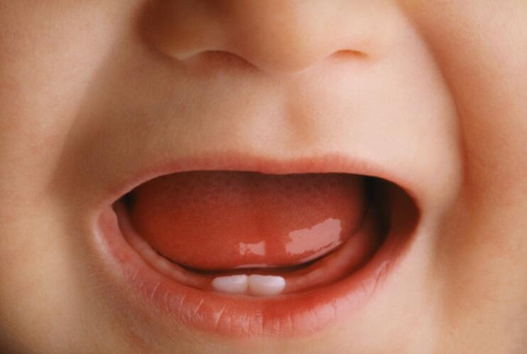 宝宝什么时候出牙？出牙顺序、表现和护理方法是什么？一文说清
