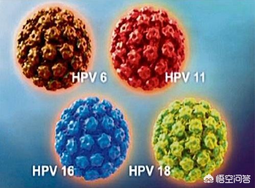 女性对于HPV病毒检查，多少岁就要坚持做了？