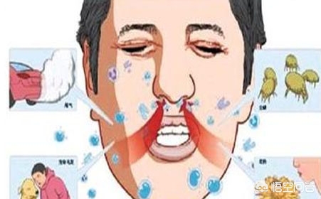 鼻窦炎吃什么药能治愈？