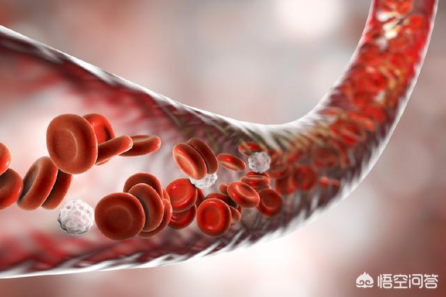 中老年人中，血管堵塞的人越来越多，有没有清血管简单又有效的方法呢？