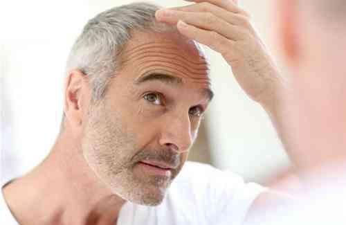 染发使人年轻。近两年，为什么一些白发中老年男子逐渐不染发了？