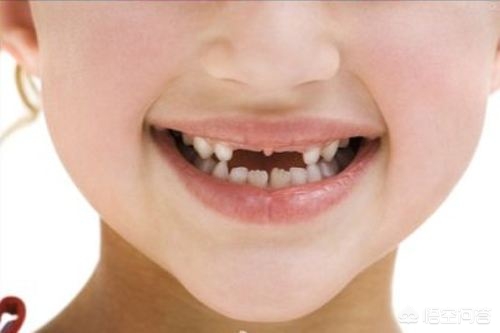 孩子大约几岁开始换牙？