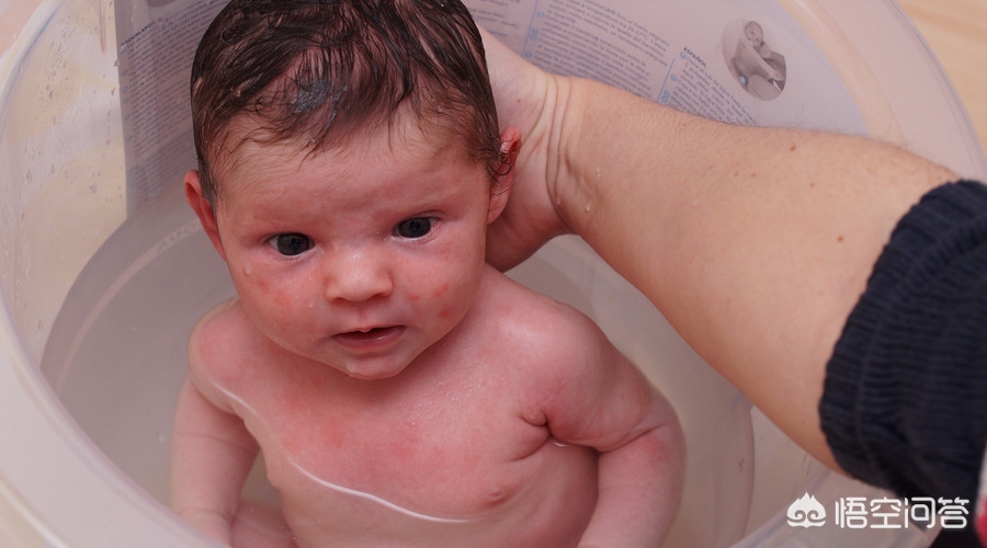 宝宝总是反复起大片湿疹，医生说是胃肠功能弱导致的免疫力低下，该怎么办？