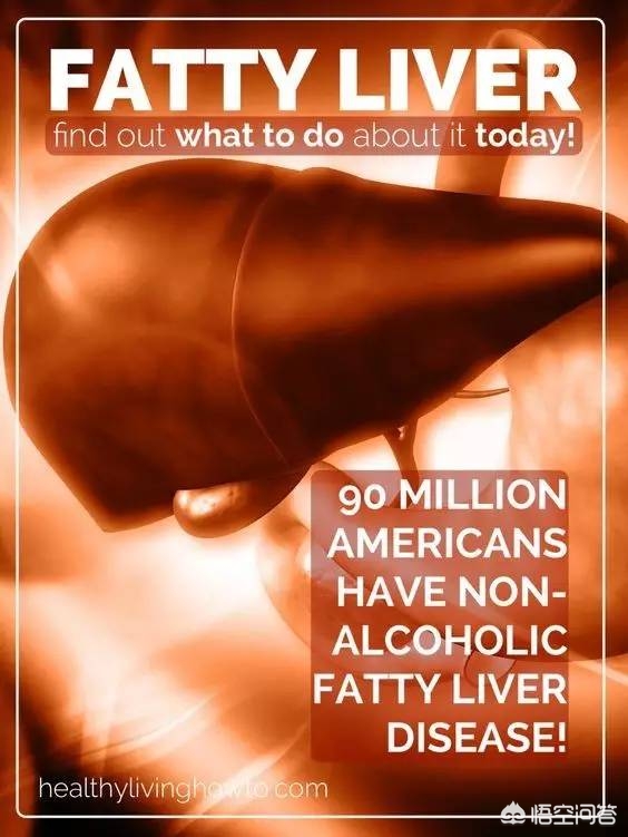 脂肪肝到底怎回事？