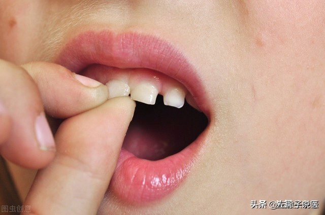 用什么方法能保住松动的牙齿？