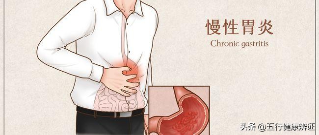 慢性胃病怎么解决？